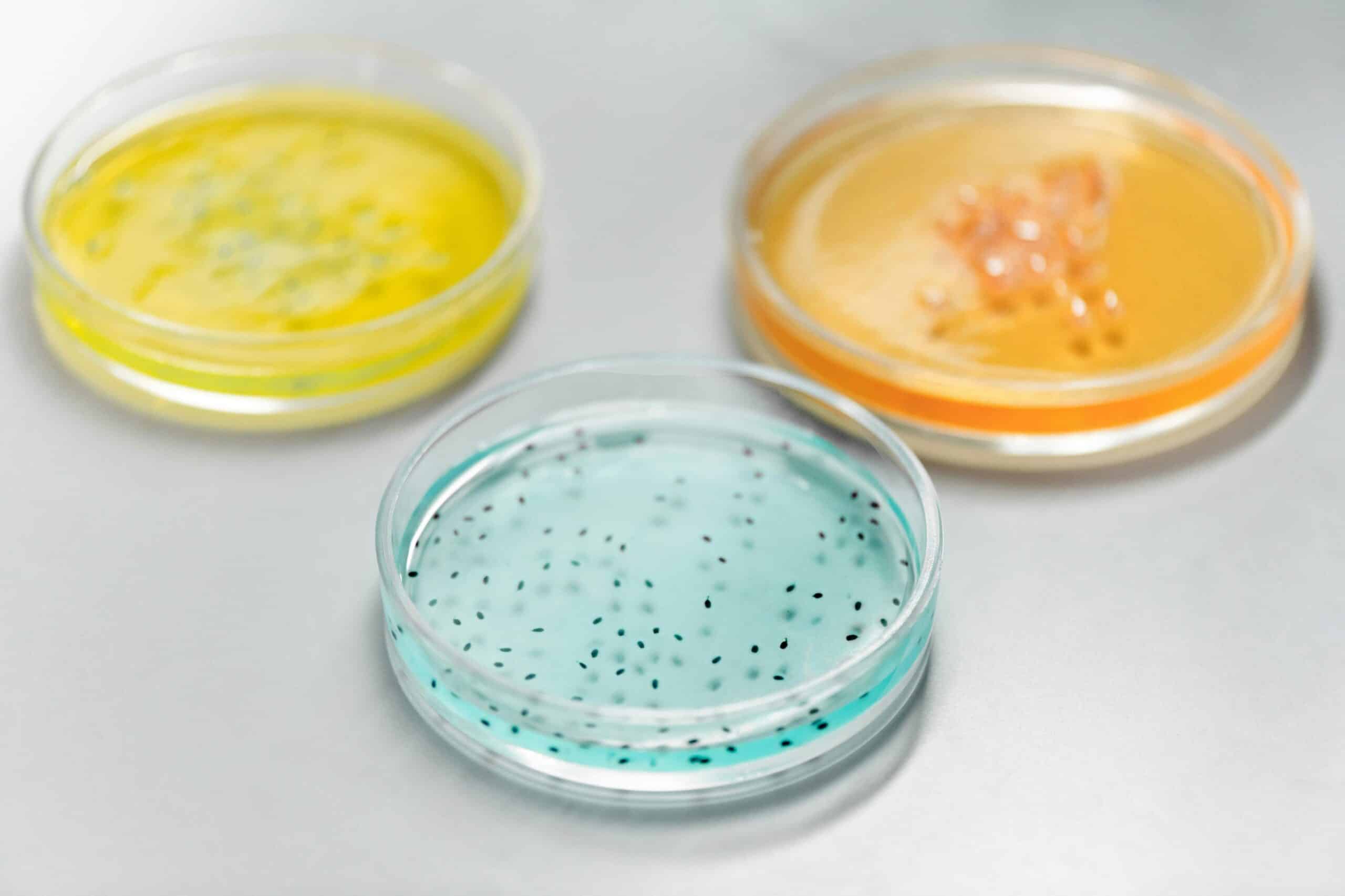 parent carries autism gene in 3 petri dishes